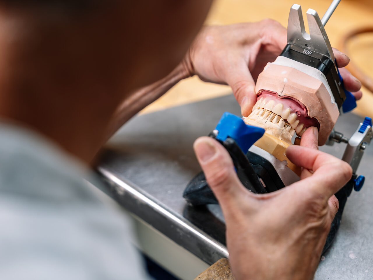 Volledige boven- en onderprothese in occlusie in een articulator, gecontroleerd op articulatie
