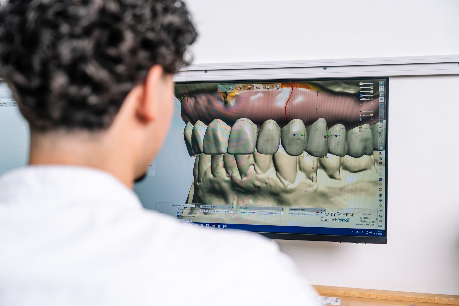 Tandtechnicus ontwerpt een digitale prothese op de CAD/CAM-afdeling