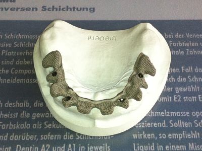 Titanium onderstructuur op het bovenmodel, bovenaanzicht