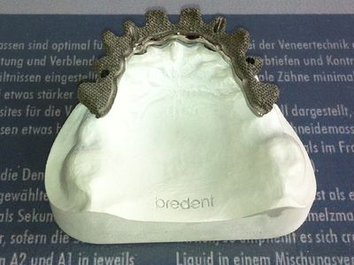 Titanium onderstructuur met retentiepatroon, schuin aanzicht