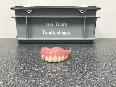 Afgewerkte bovenprothese voor de transportbak van het laboratorium