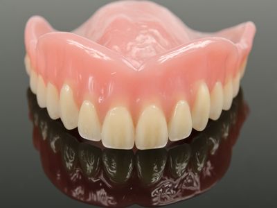 Volledige bovenprothese
