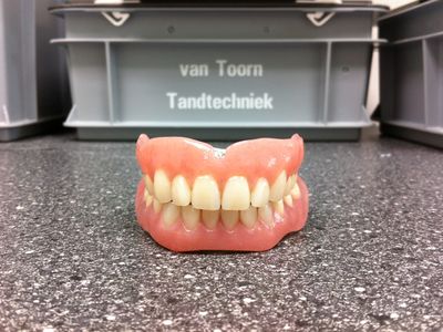 Volledige boven- en onderprothese in het laboratorium