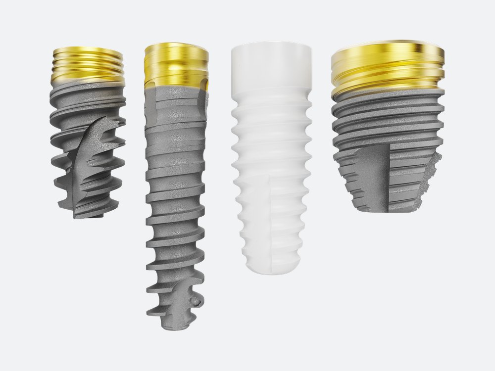 Vier dentale implantaten in titanium en keramiek